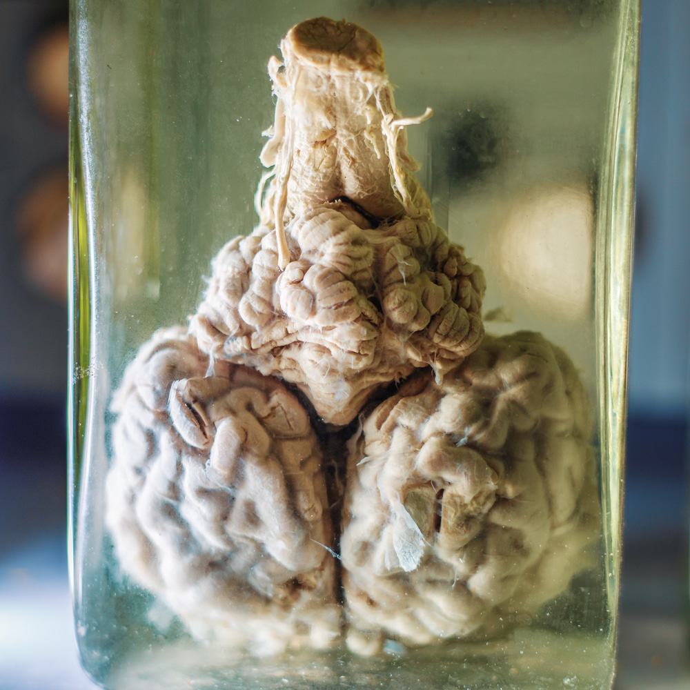 Mammalian Brain Collection, Silver Spring